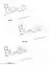 Fig. 03 - Vacuum wound therapy wound dressing with variable performance zones
