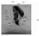 Fig. 01 - System and method for mounting medical equipment