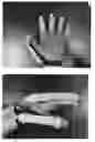 Fig. 01 - Flexibly driven robotic hands