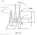 Fig. 08 - Auricular peripheral nerve field stimulator and method of operating same