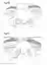 Fig. 04 - Image recognition-based dosage form dispensers