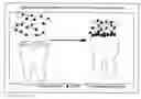 Fig. 01 - Polyphenols/PEG based hydrogel system for a dental varnish
