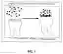 Fig. 02 - Polyphenols/PEG based hydrogel system for a dental varnish