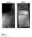 Fig. 08 - Polyphenols/PEG based hydrogel system for a dental varnish