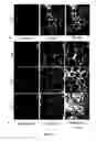 Fig. 02 - Methods and pharmaceutical compositions for the treatment of retinal capillary non-perfusion