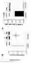 Fig. 03 - Methods and pharmaceutical compositions for the treatment of retinal capillary non-perfusion