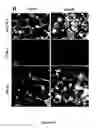 Fig. 05 - Methods and pharmaceutical compositions for the treatment of retinal capillary non-perfusion