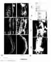 Fig. 07 - Methods and pharmaceutical compositions for the treatment of retinal capillary non-perfusion