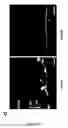 Fig. 08 - Methods and pharmaceutical compositions for the treatment of retinal capillary non-perfusion