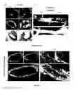 Fig. 10 - Methods and pharmaceutical compositions for the treatment of retinal capillary non-perfusion