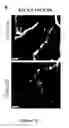 Fig. 12 - Methods and pharmaceutical compositions for the treatment of retinal capillary non-perfusion
