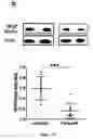 Fig. 13 - Methods and pharmaceutical compositions for the treatment of retinal capillary non-perfusion