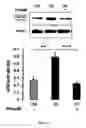 Fig. 16 - Methods and pharmaceutical compositions for the treatment of retinal capillary non-perfusion