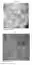 Fig. 26 - Microvesicles derived from nucleated, mammalian cells and use thereof