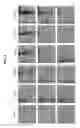 Fig. 04 - MODULAR TRANSDERMAL DELIVERY SYSTEM AND ASSOCIATED METHODS OF MANUFACTURE AND USE