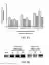 Fig. 06 - Method for enhancing folding and transport of misfolded glucocerebrosidase