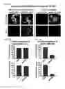 Fig. 69 - Methods for detection and eradication of myeloid leukemia stem cells