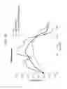Fig. 11 - METHODS AND COMPOSITIONS FOR TREATING NEURODEGENERATIVE DISEASES