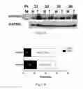 Fig. 02 - Methods of diagnosing and treating hepatocellular carcinoma