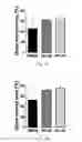 Fig. 04 - Methods of diagnosing and treating hepatocellular carcinoma