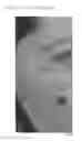 Fig. 05 - Compositions and methods for treating conditions of compromised skin barrier function