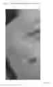 Fig. 06 - Compositions and methods for treating conditions of compromised skin barrier function