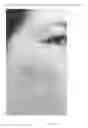 Fig. 08 - Compositions and methods for treating conditions of compromised skin barrier function
