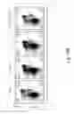 Fig. 34 - CRISPR/Cas-related methods and compositions for improving transplantation
