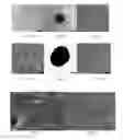 Fig. 06 - Use of allogeneic interstitial vessel-layer cell and allogeneic mesenchymal progenitor cell for preventing or treating osteoarthritis