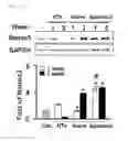 Fig. 15 - Compositions containing SPHEROID CELL AGGREGATES for enhance ovary function and preparation method of the same