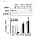 Fig. 17 - Compositions containing SPHEROID CELL AGGREGATES for enhance ovary function and preparation method of the same