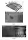 Fig. 07 - METHODS OF DIAGNOSING AND TREATING VASCULAR ASSOCIATED MACULOPATHY AND SYMPTOMS THEREOF