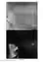Fig. 08 - METHODS OF DIAGNOSING AND TREATING VASCULAR ASSOCIATED MACULOPATHY AND SYMPTOMS THEREOF