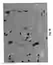 Fig. 11 - METHOD TO INDUCE NEOVASCULAR FORMATION AND TISSUE REGENERATION