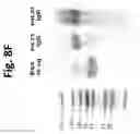 Fig. 21 - Method of treating cancer with compositions comprising IL-31