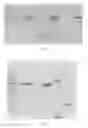 Fig. 02 - Immunogenic composition for preventing pneumococcal diseases and preparation method thereof