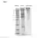 Fig. 02 - Acellular corneas, methods of producing the same and uses thereof