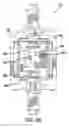 Fig. 06 - Reversible peristaltic pump and other structures for reflux in eye surgery