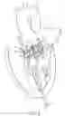 Fig. 04 - Catheter-based heart support system and method of implanting thereof