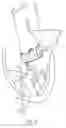 Fig. 06 - Catheter-based heart support system and method of implanting thereof