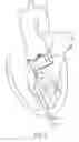 Fig. 07 - Catheter-based heart support system and method of implanting thereof