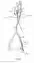 Fig. 10 - Catheter-based heart support system and method of implanting thereof