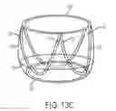 Fig. 14 - Catheter-based heart support system and method of implanting thereof