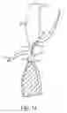 Fig. 15 - Catheter-based heart support system and method of implanting thereof