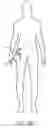 Fig. 17 - Catheter-based heart support system and method of implanting thereof