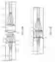 Fig. 18 - Catheter-based heart support system and method of implanting thereof