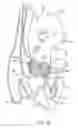 Fig. 20 - Catheter-based heart support system and method of implanting thereof