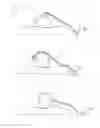 Fig. 06 - Respiratory assistance device