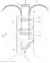 Fig. 01 - Intubation device with variable backflow pressure