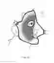 Fig. 16 - Facial mask apparatus and method of making